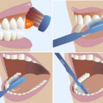 Técnica correcta del cepillado de dientes
