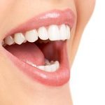 El tratamiento de ortodoncia te da la sonrisa perfecta