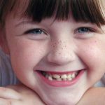 A los 7 años se debe realizar la primera visita al ortodoncista