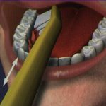 tecnica Los dientes se lavan de atrás para adelante